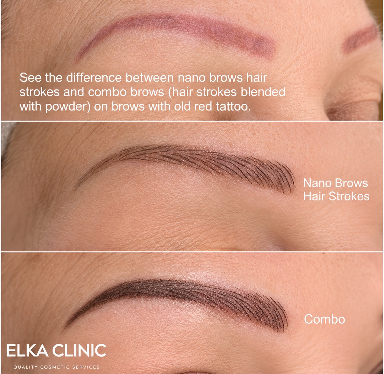 Three-panel sequence showing previous red brow tattoo, Nano hair strokes and immediate Combination Brows result.