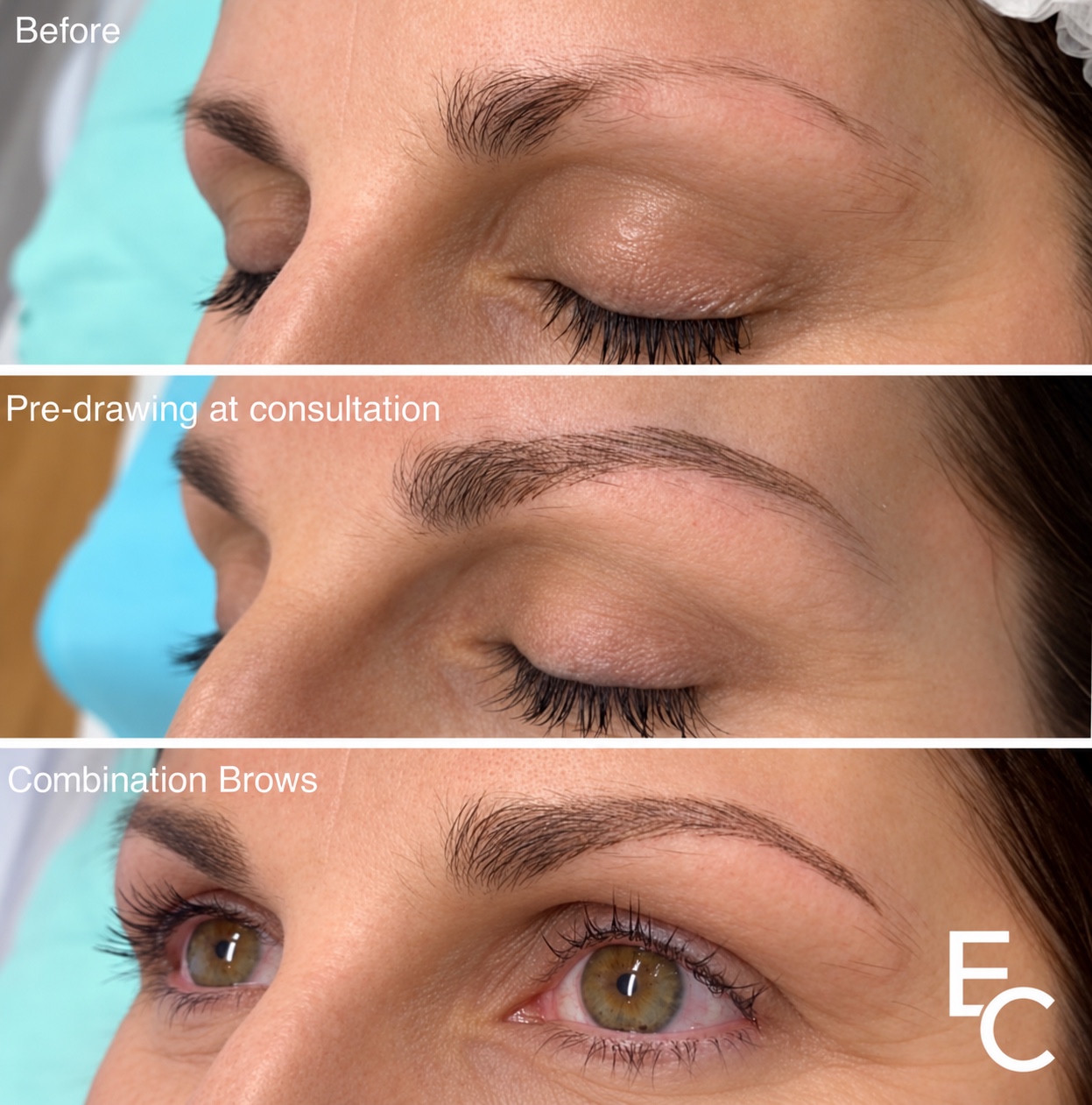 Three-panel comparison showing brows before treatment, consultation pre-drawing and immediate Combination Brows result.