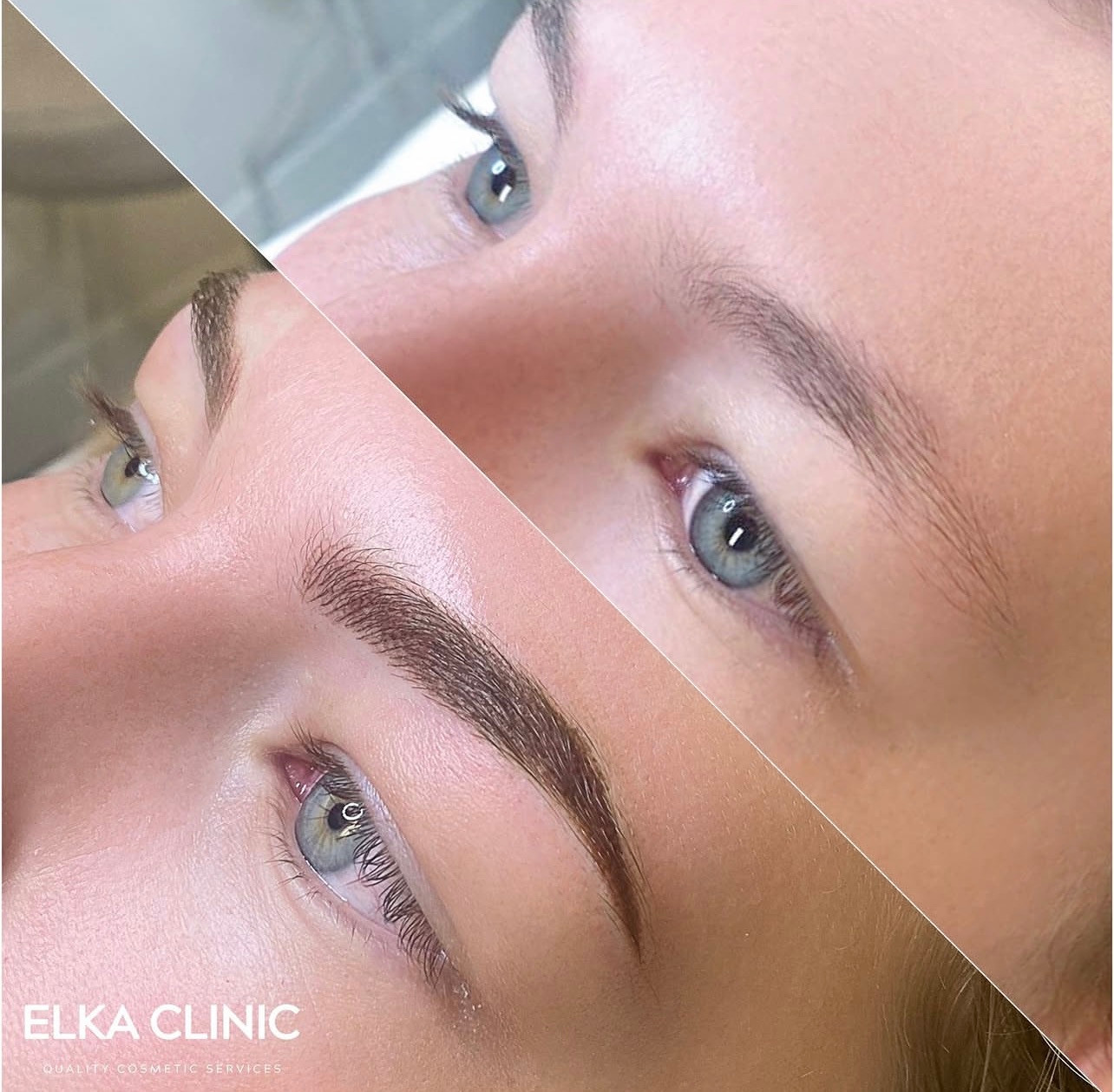 Two-panel brow tattoo comparison with the treatment result photographed immediately after treatment.