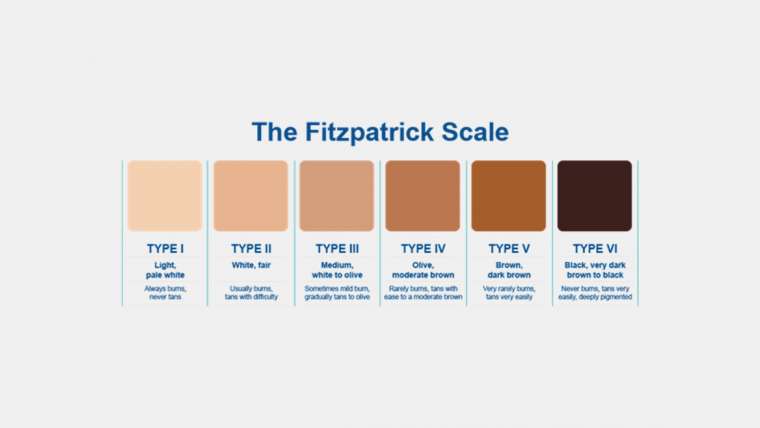 The Fitzpatrick Skin-Type Chart