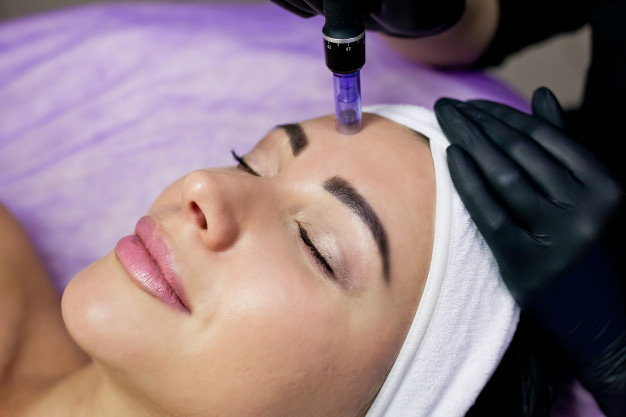 Everything about better looking skin with Microneedling