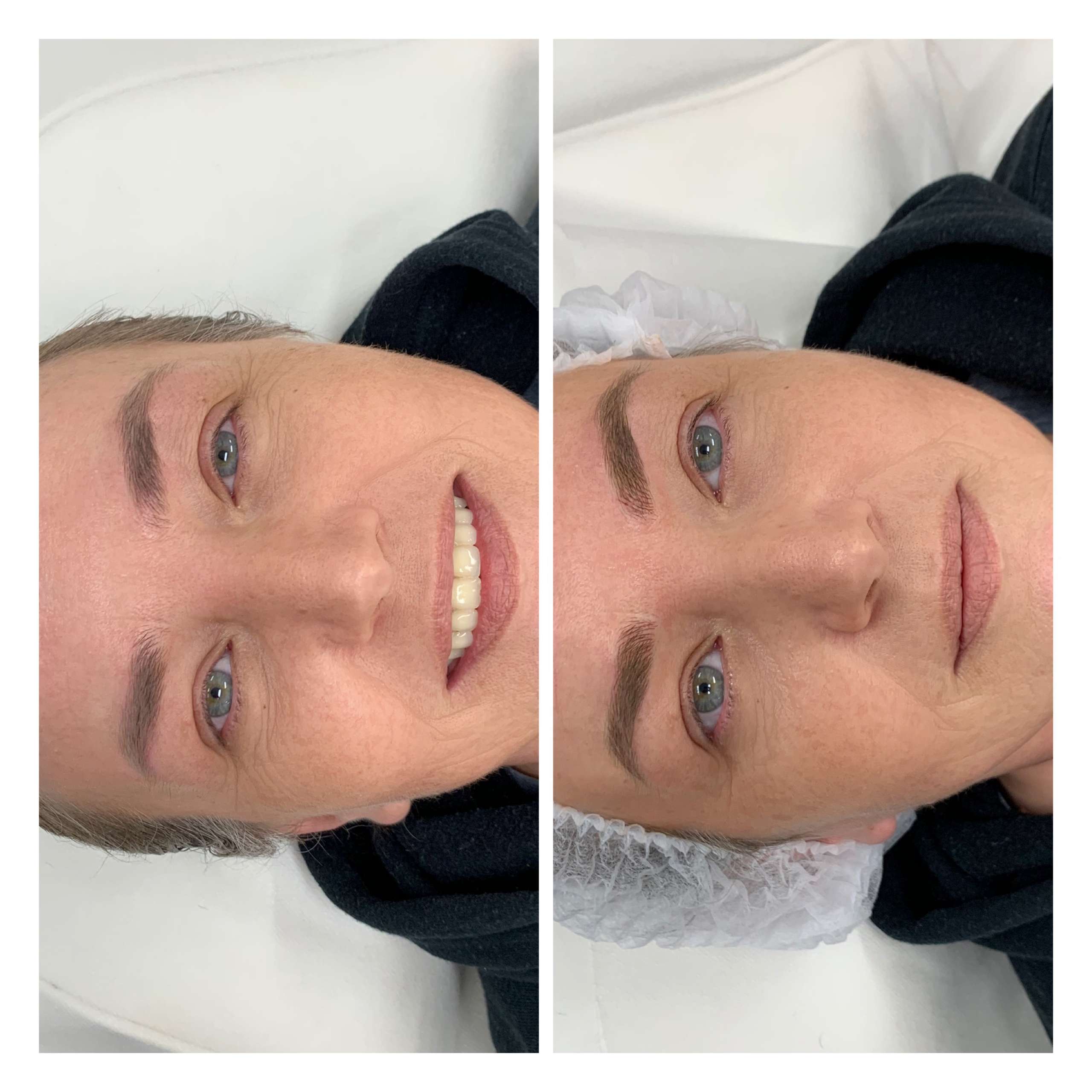 Eyebrow Microblading Before After (1)