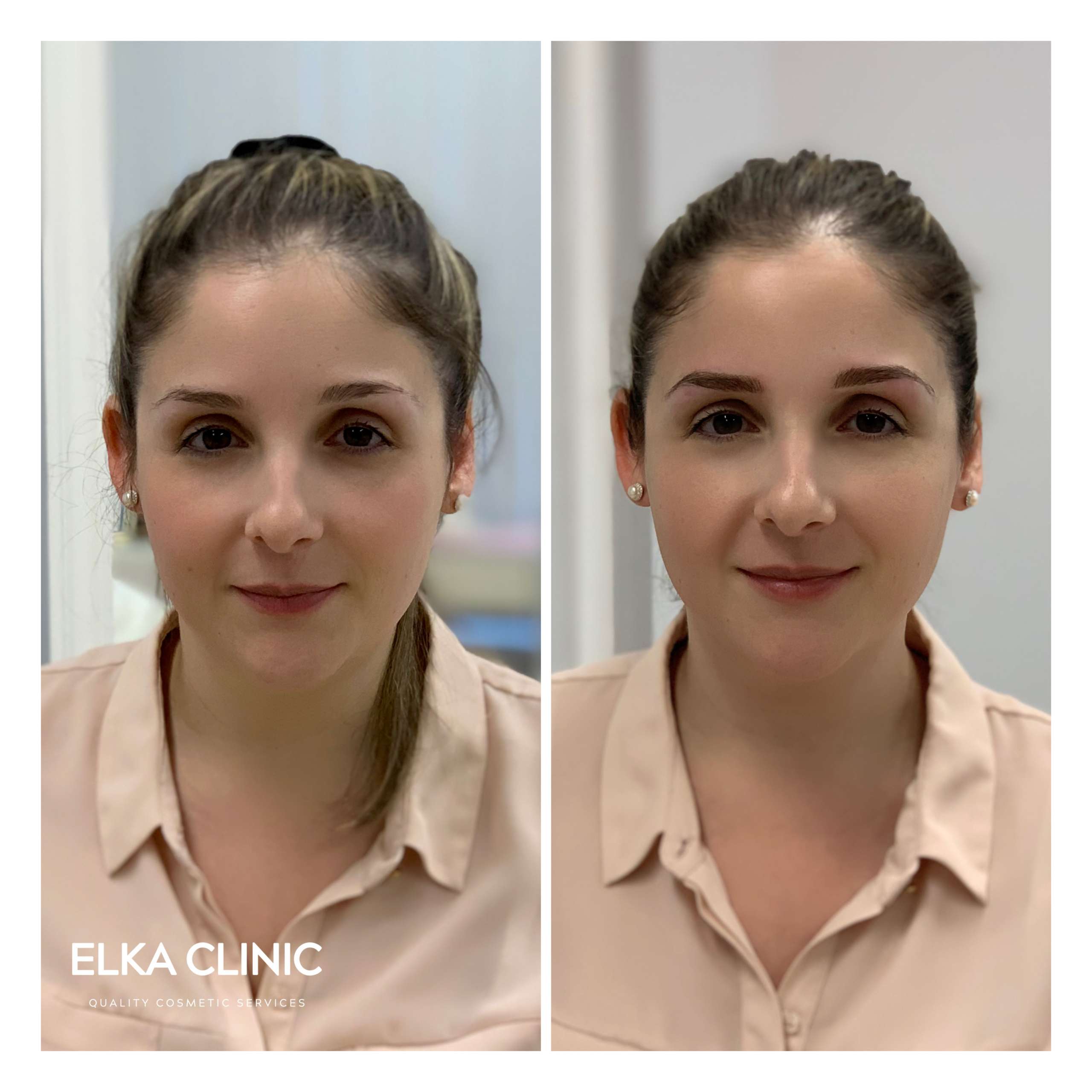 Eyebrow Microblading Before After