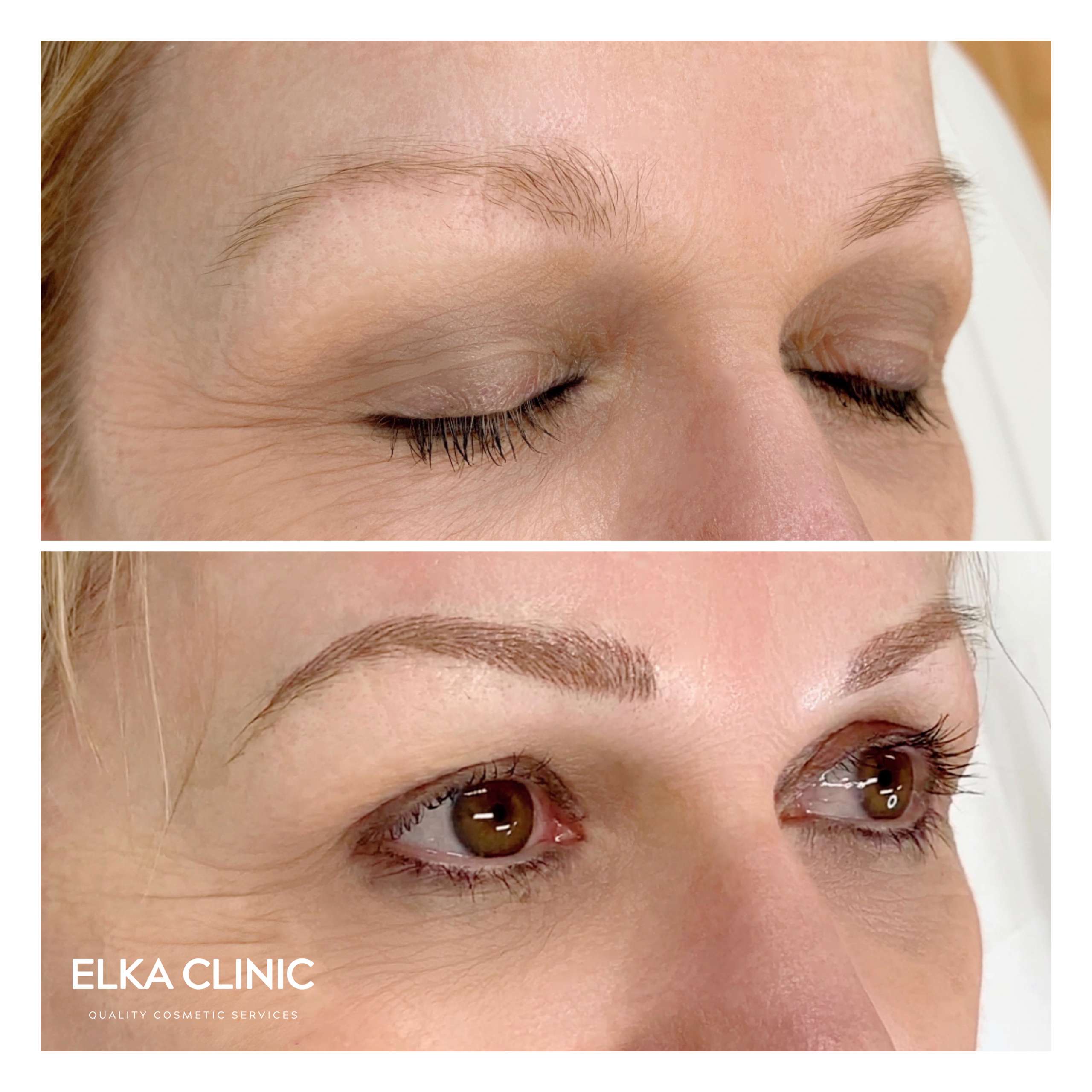 Nano Brows for Blonde by ELKA CLINIC
