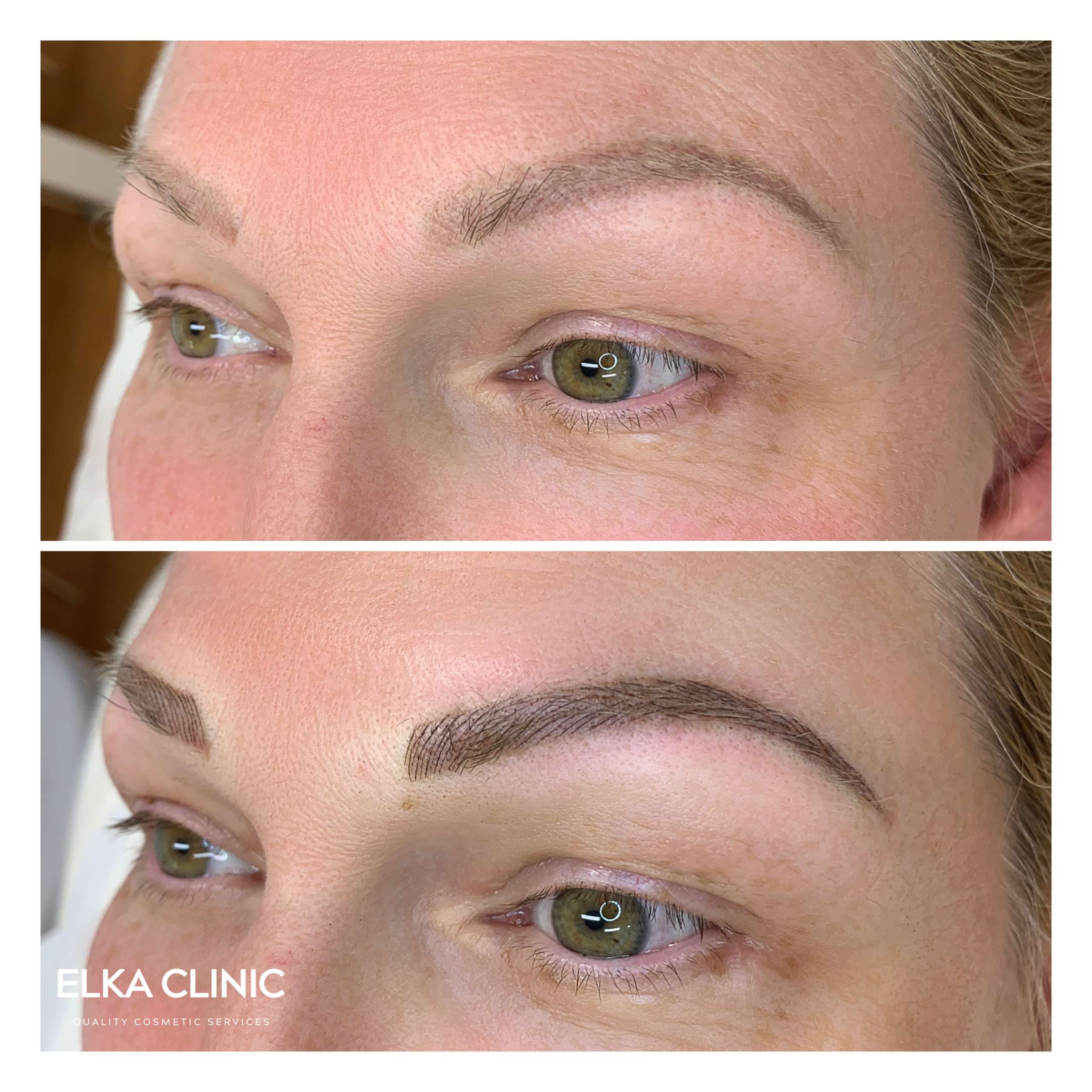 Eyebrow Tattooing Color Correction or Shape Change