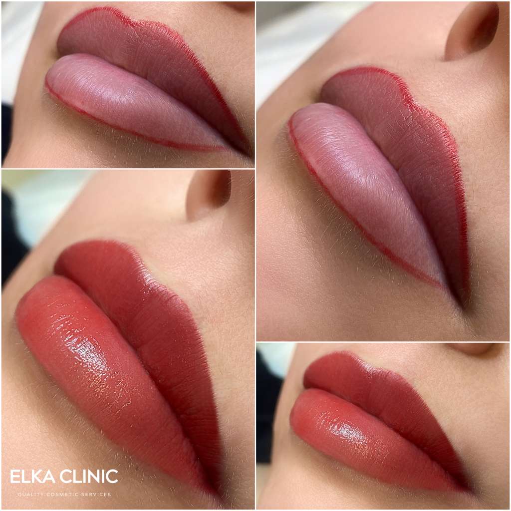 Healed lip blush and soft lip liner definition, ELKA Clinic Perth