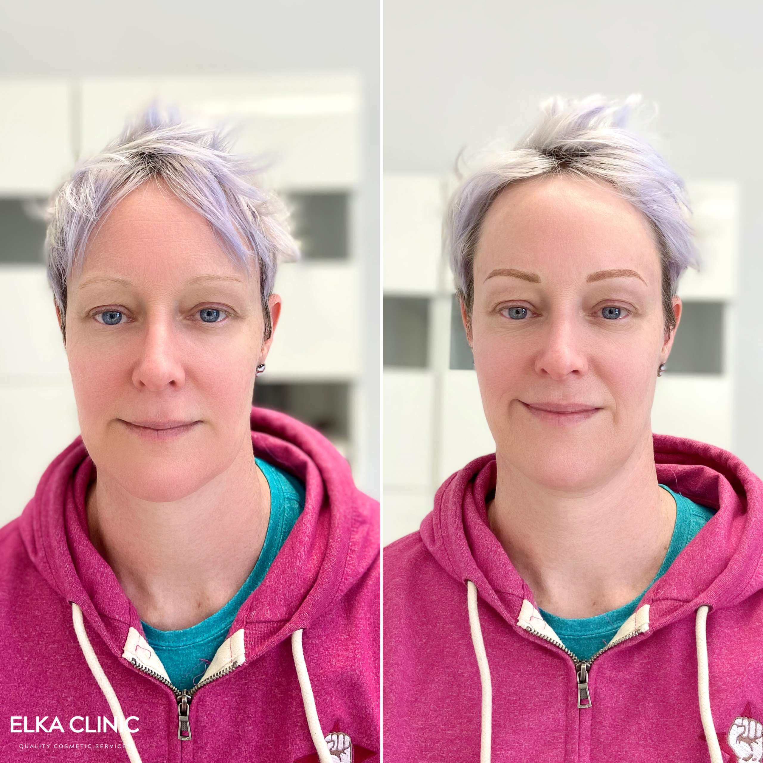 Nanobrows Before and After