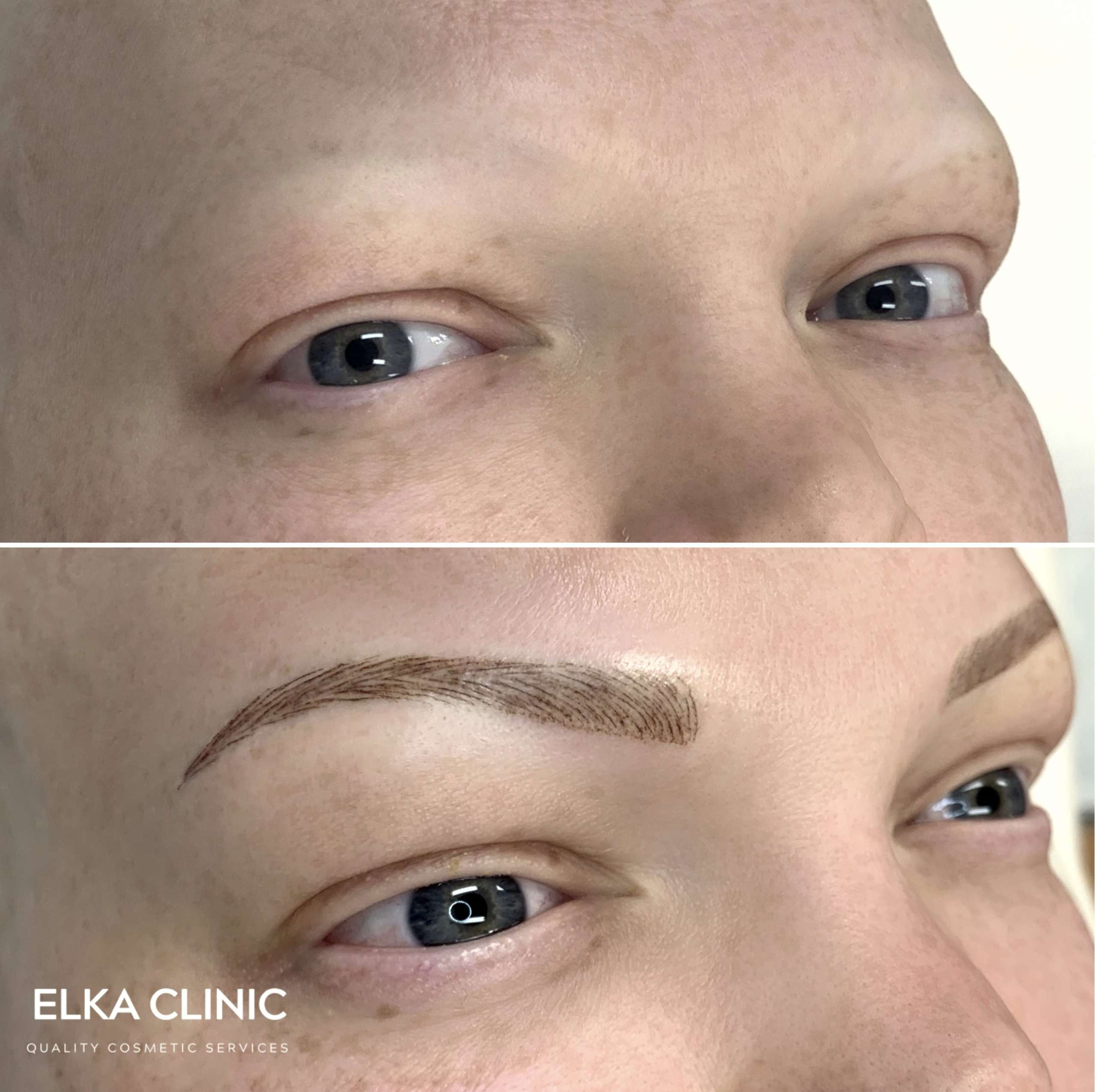 Nanobrows & eyebrow tattooing for clients with alopecia or during chemotherapy or sparse and no hair brows
