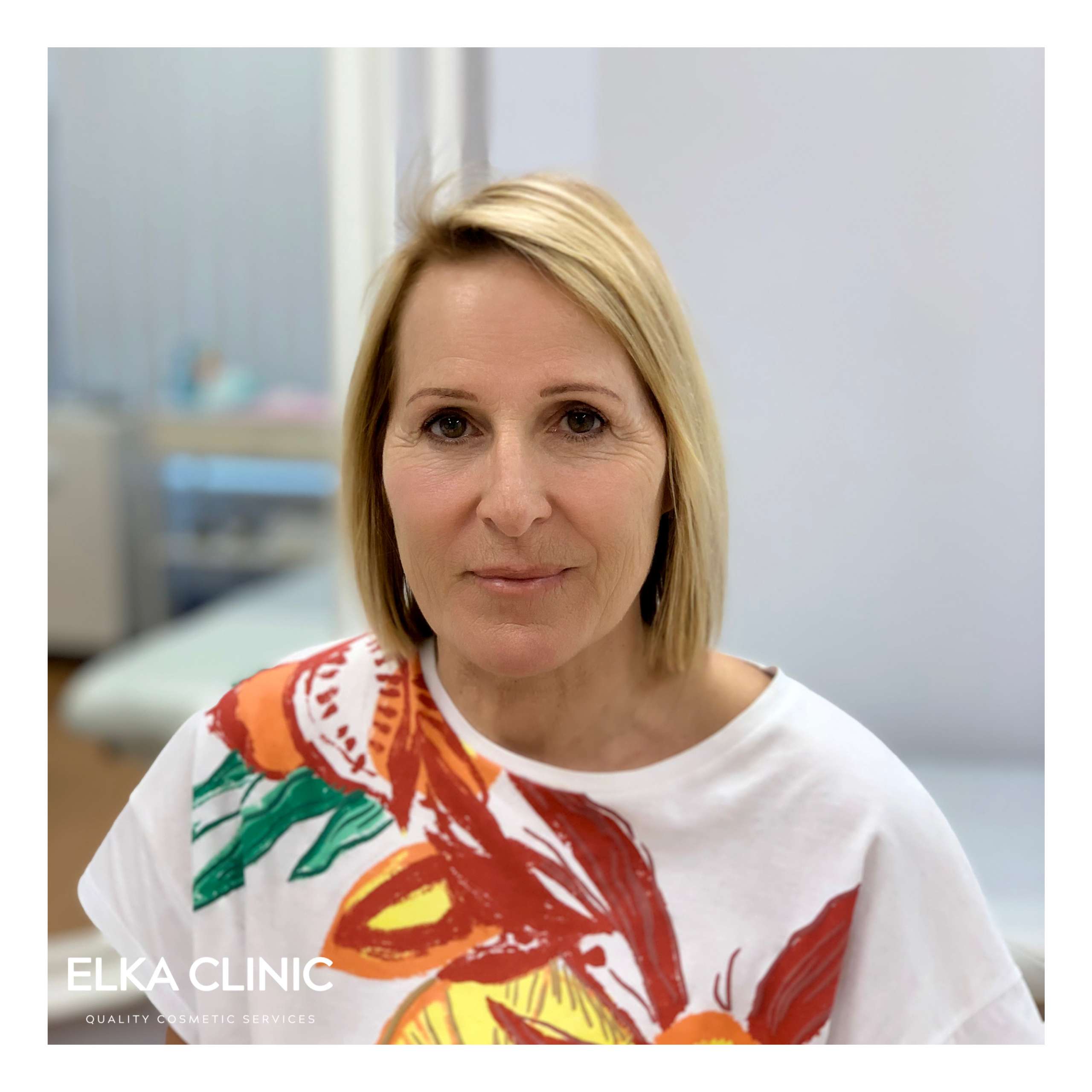 Eyebrow Microblading healed result Eyebrow Microblading healed result