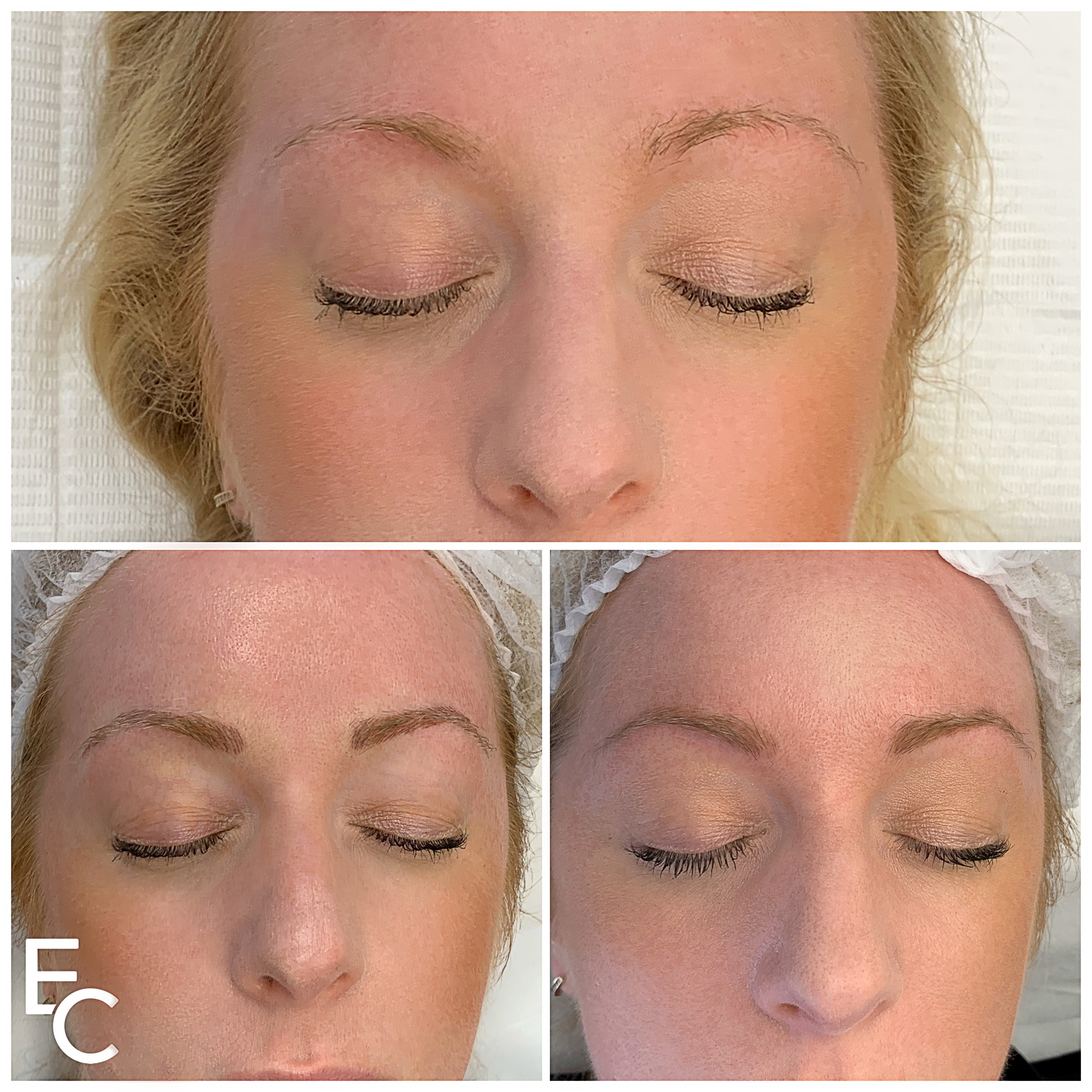 Eyebrow Microblading healed result