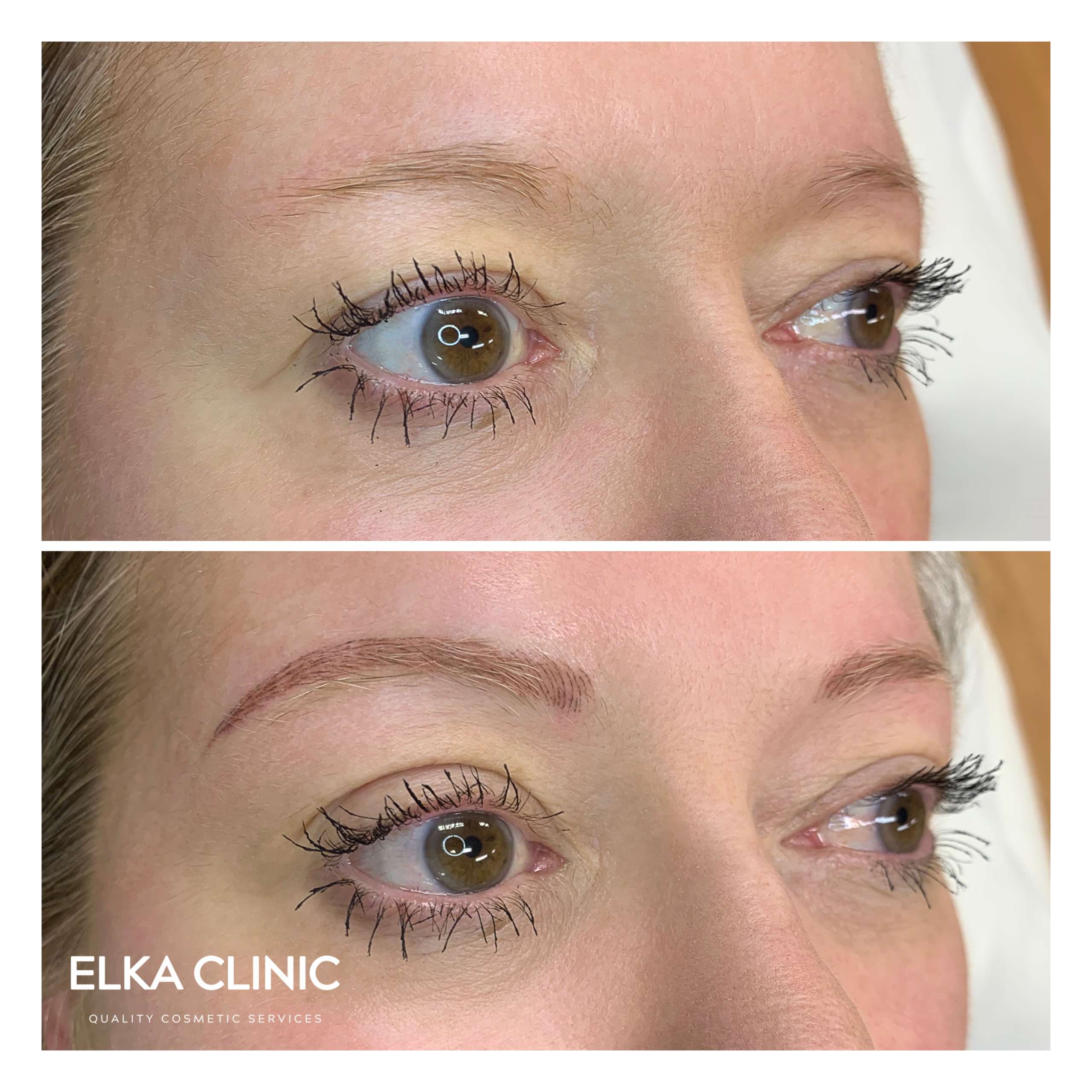 Eyebrow Tattooing Nano Brows on thin, short or sparse brows by ELKA CLINIC