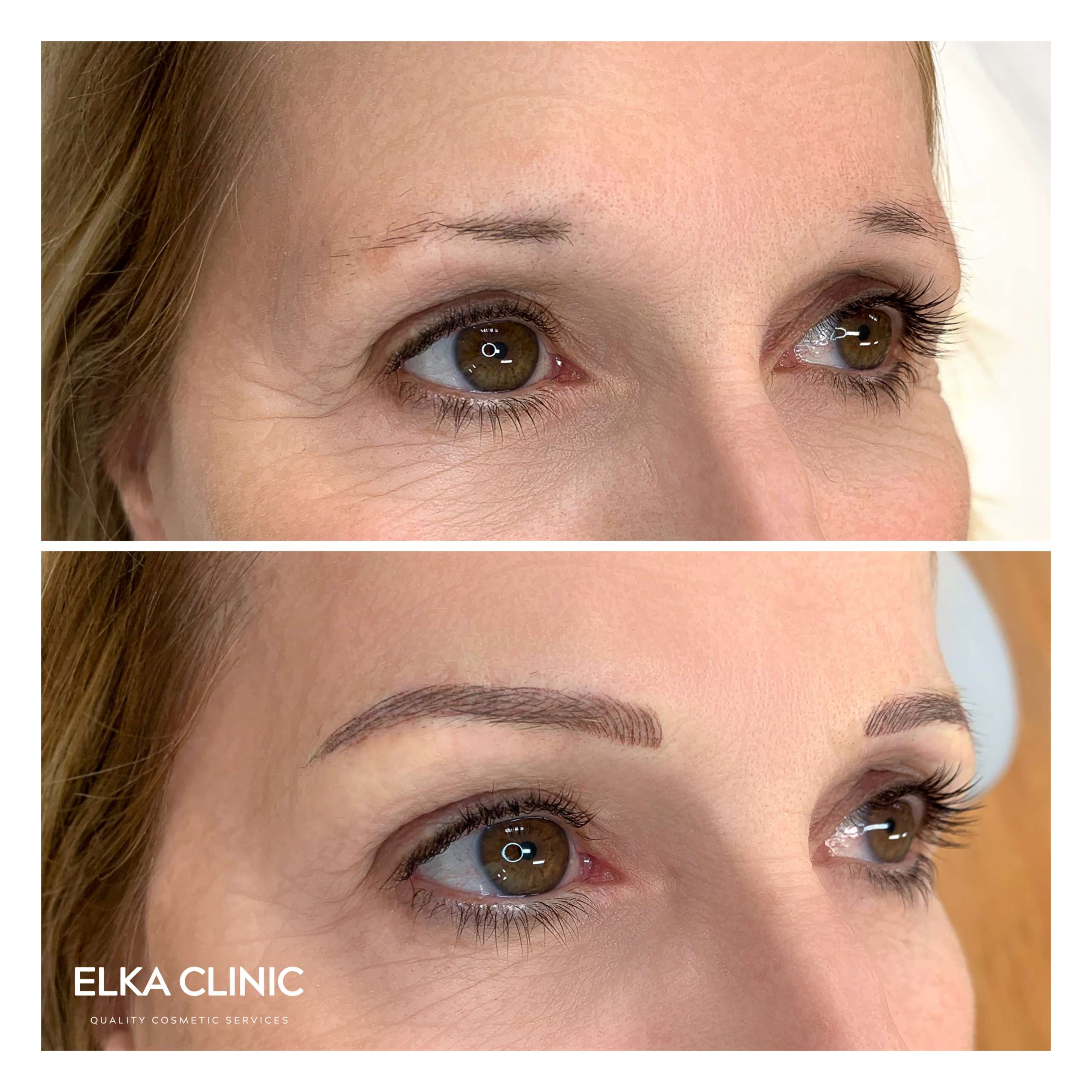 Nano Brows on thin, short or sparse brows by ELKA CLINIC Nano Brows on thin, short or sparse brows by ELKA CLINIC