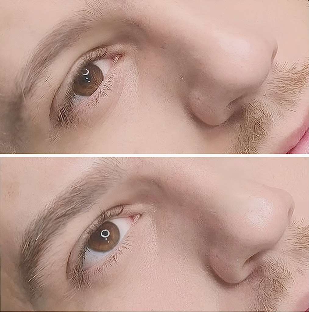 Men’s Brow Tattooing