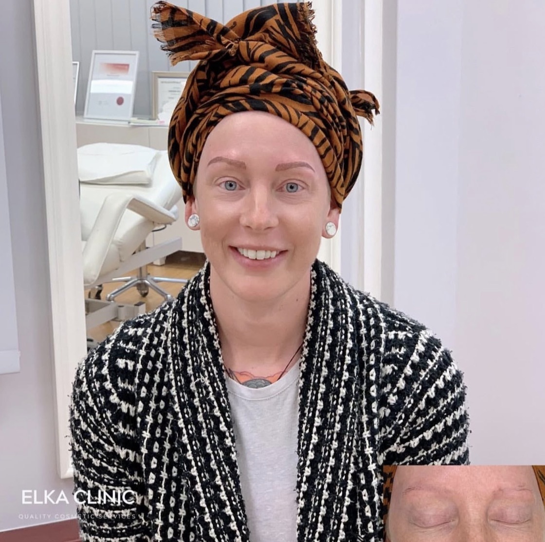 Calm, natural-looking cosmetic tattoo result at ELKA CLINIC