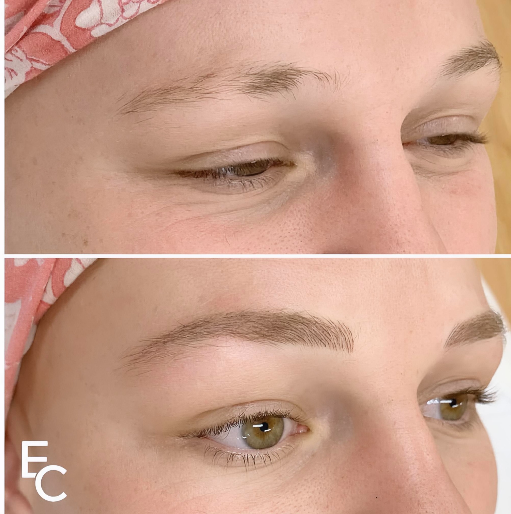 ELKA CLINIC client during a calm, private cosmetic tattoo consultation
