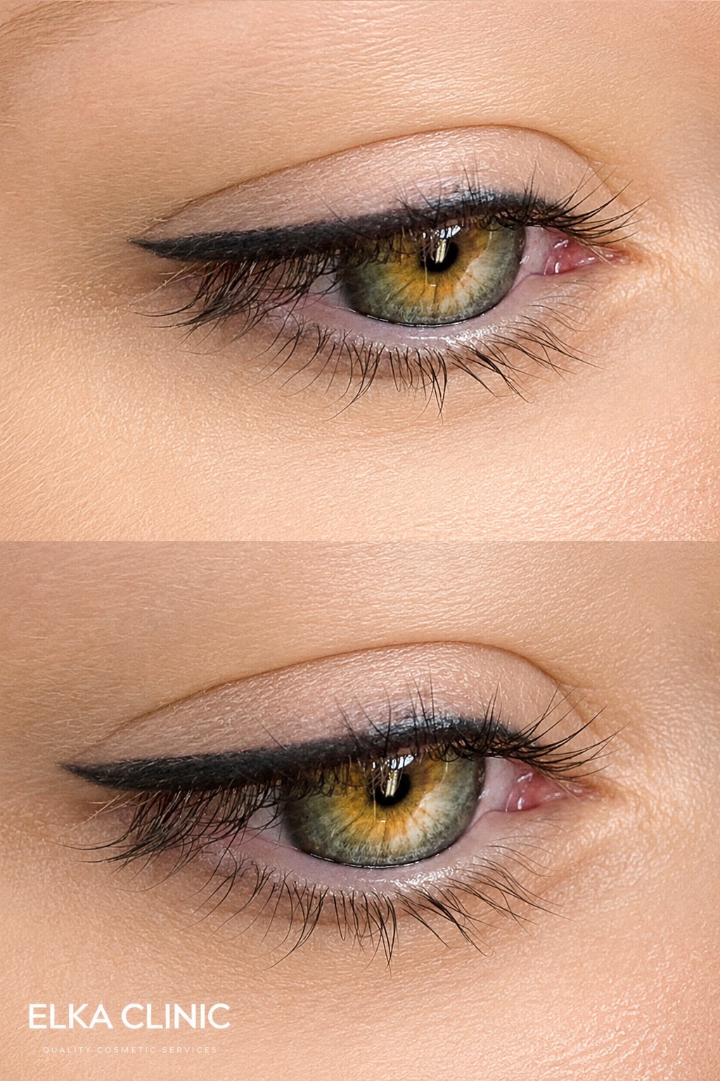 Close up of eyeliner tattoo during the healing phase at ELKA CLINIC Perth