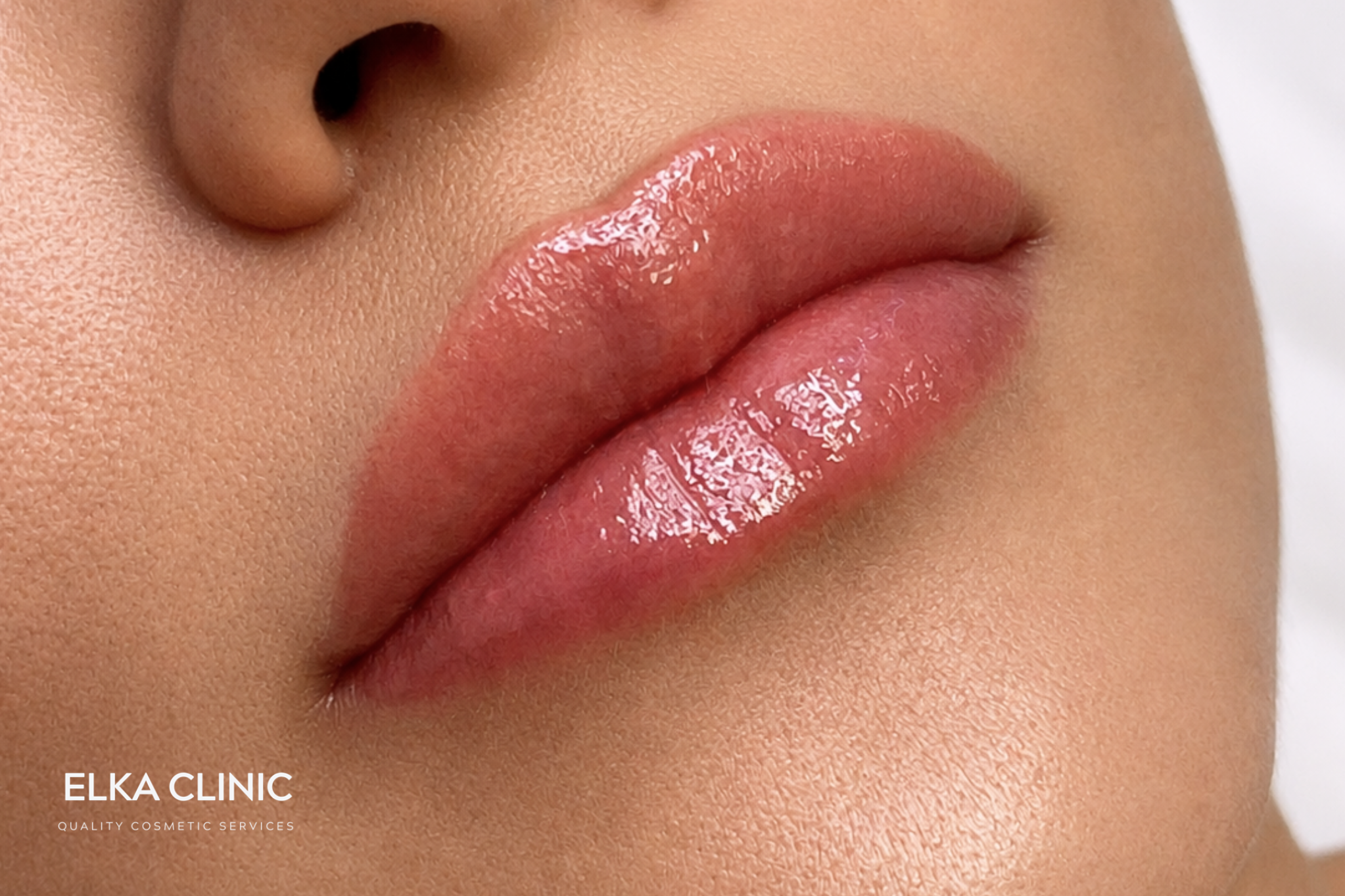Natural healed lip blush tattoo result at ELKA Clinic Perth