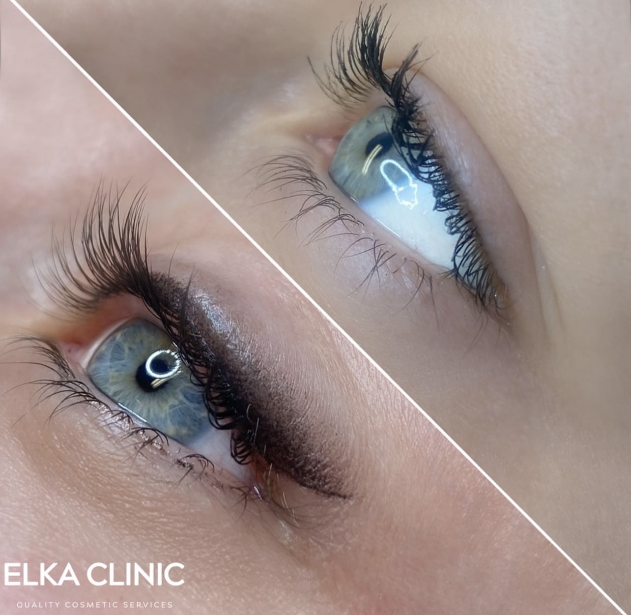 Elegant classic eyeliner tattoo result at ELKA Clinic Perth