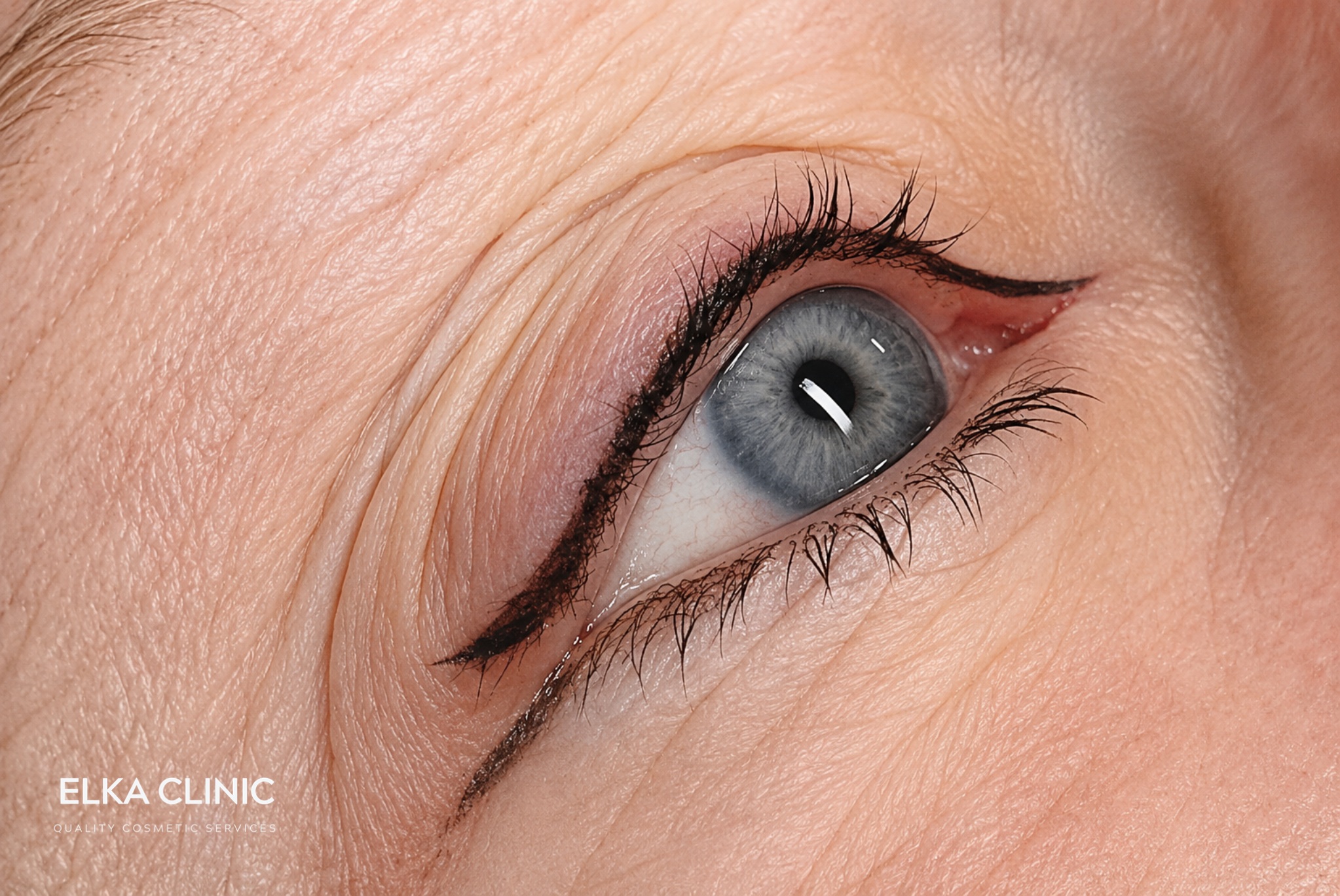 Client considering eyeliner tattoo at ELKA Clinic Perth