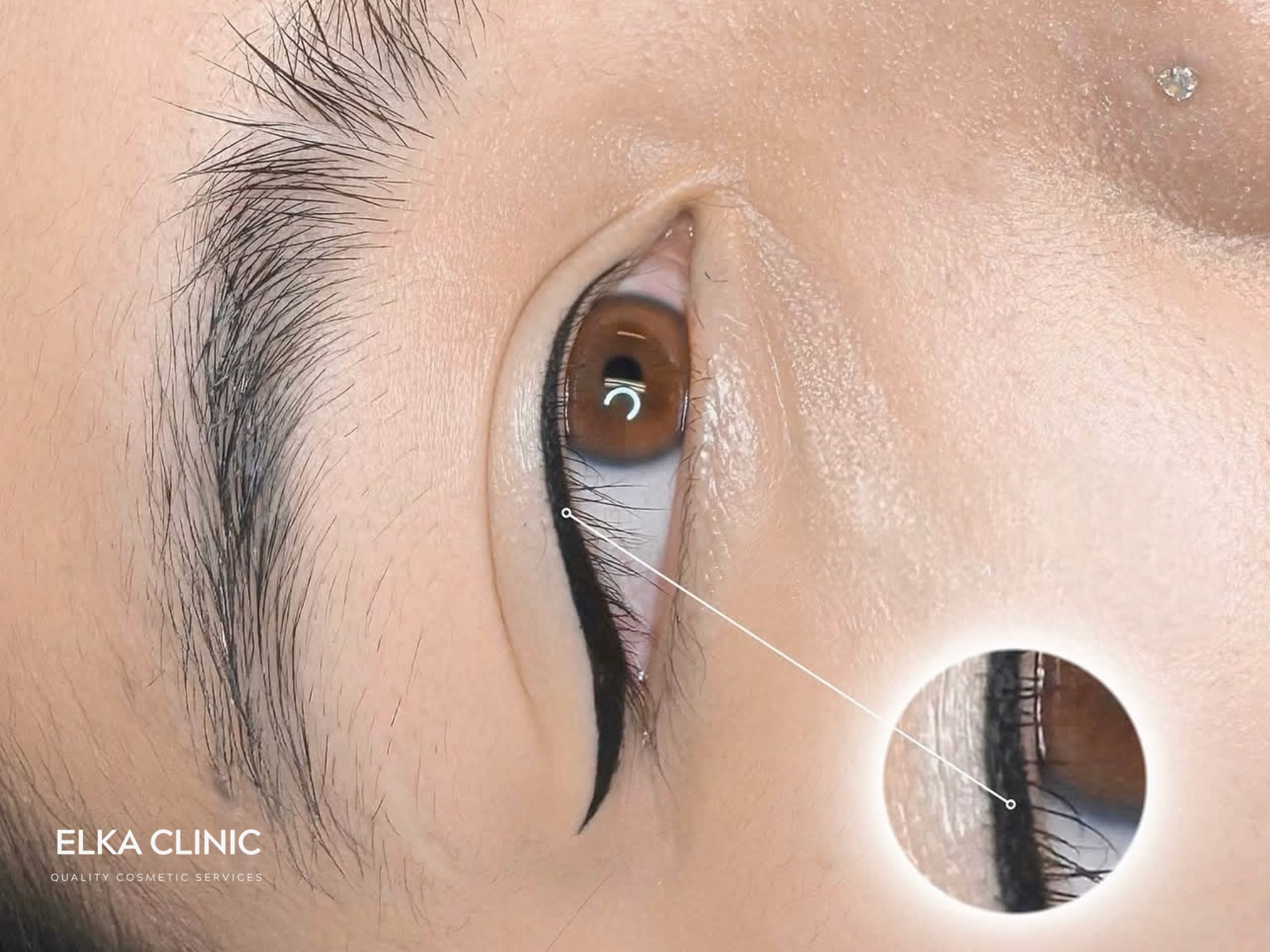 Eyeliner tattoo designed for monolid and Asian eye shapes at ELKA CLINIC Perth