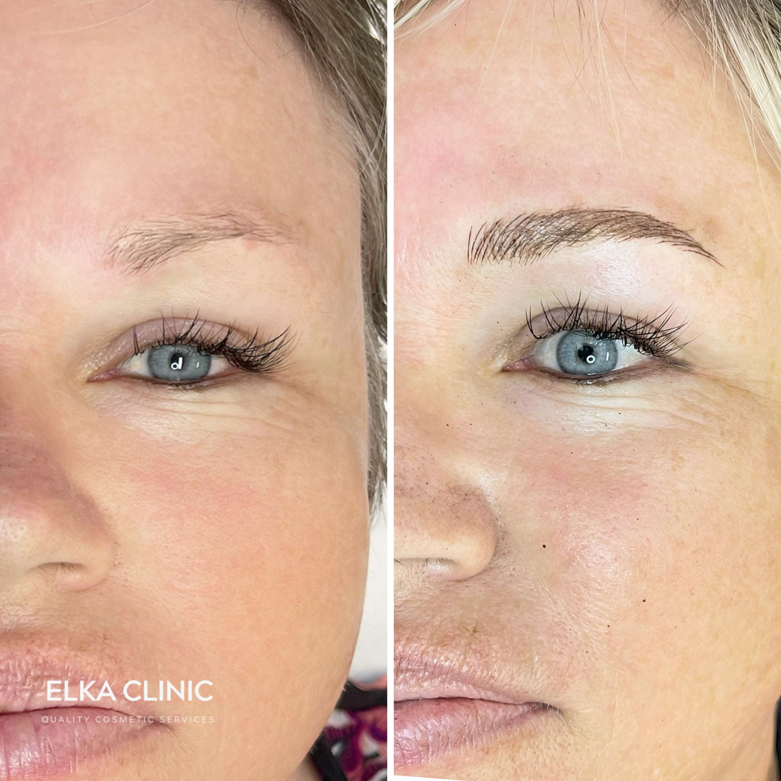 Nano Brows before and after on blonde mature skin — ELKA Clinic Perth