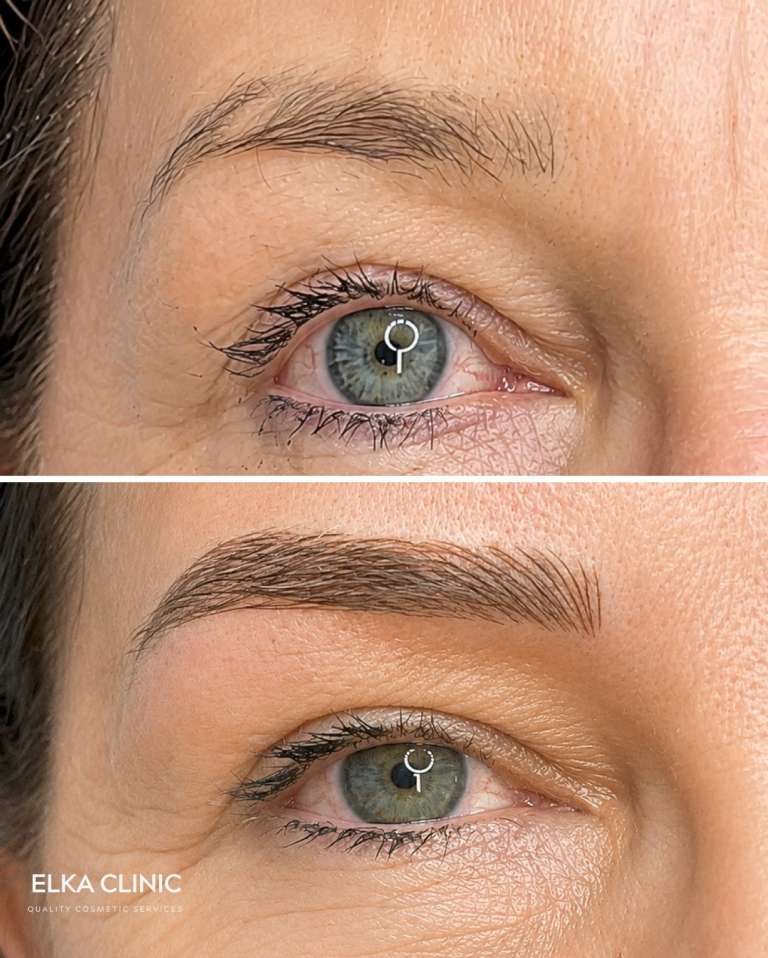 Close-up of healed Nano Brows on mature skin around the eye at ELKA CLINIC Perth