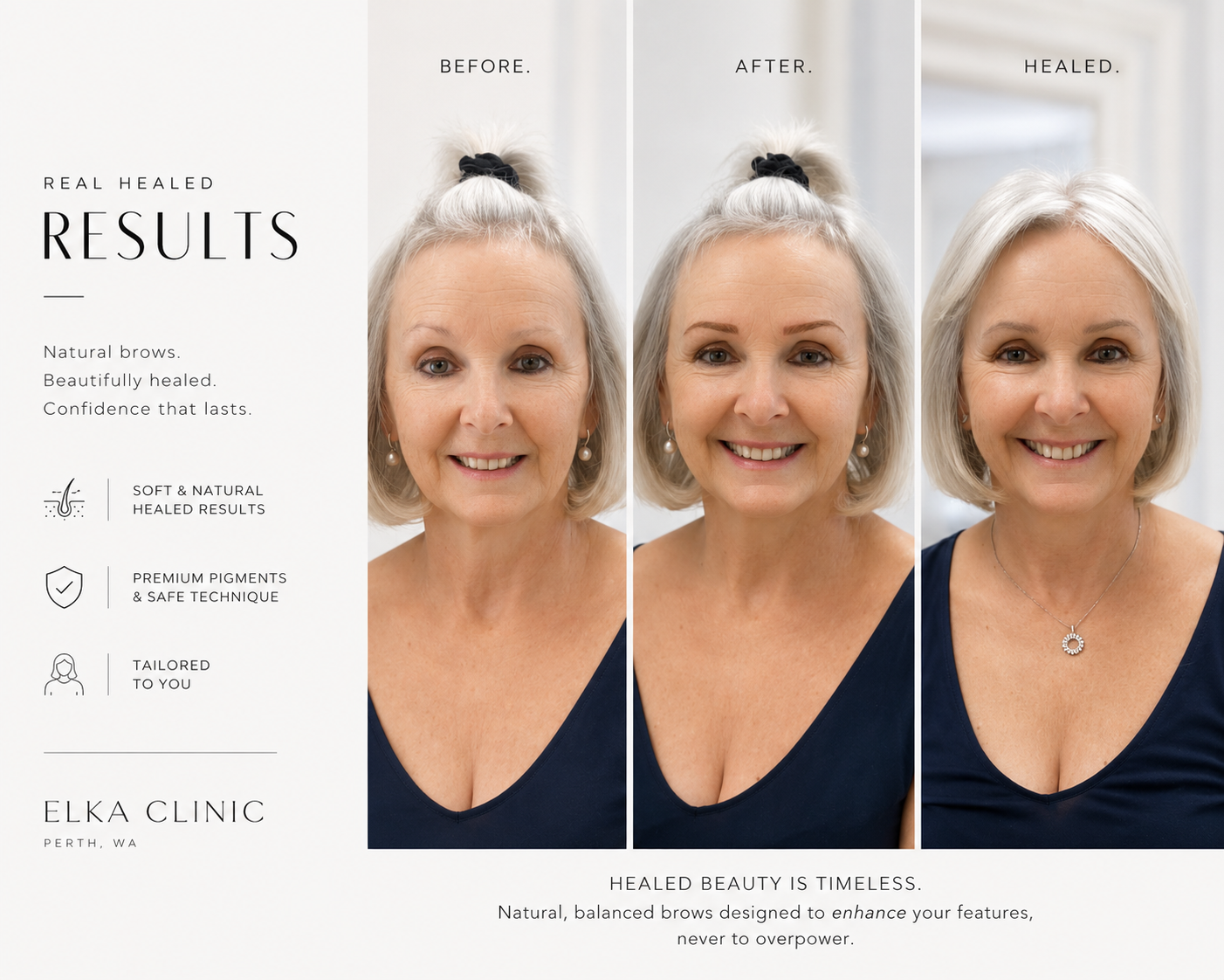 Nano Brows for mature skin — before, after and healed brow tattoo results on a mature client at ELKA Clinic Perth