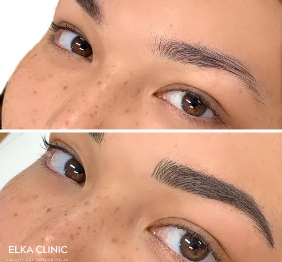 Before and after nano brows eyebrow tattoo at ELKA Clinic Perth