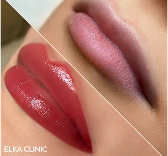 Before and after lip blushing lip tattoo at ELKA Clinic Perth
