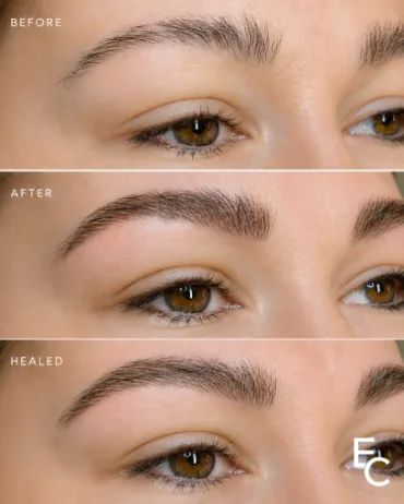 Nano brows and microblading before, after and healed results at ELKA Clinic Perth