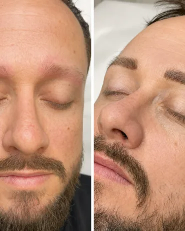 Men’s nano brows before and after at ELKA Clinic Perth