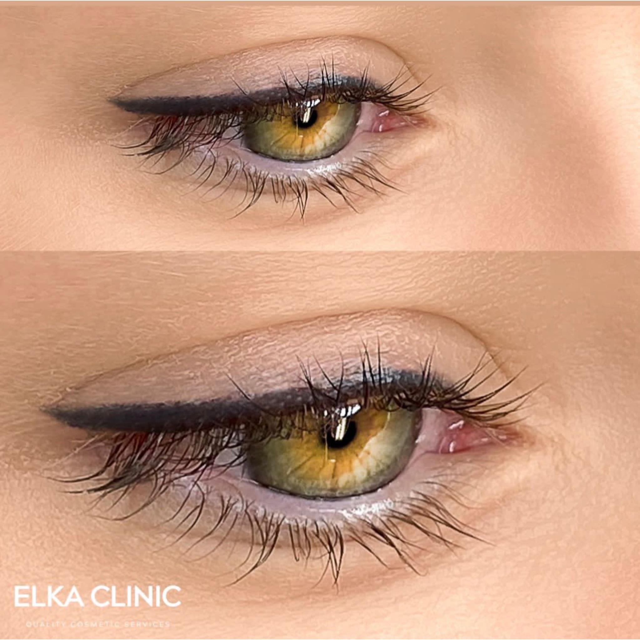 Eyeliner tattoo healing timeline showing the stages from fresh to healed at ELKA CLINIC Perth