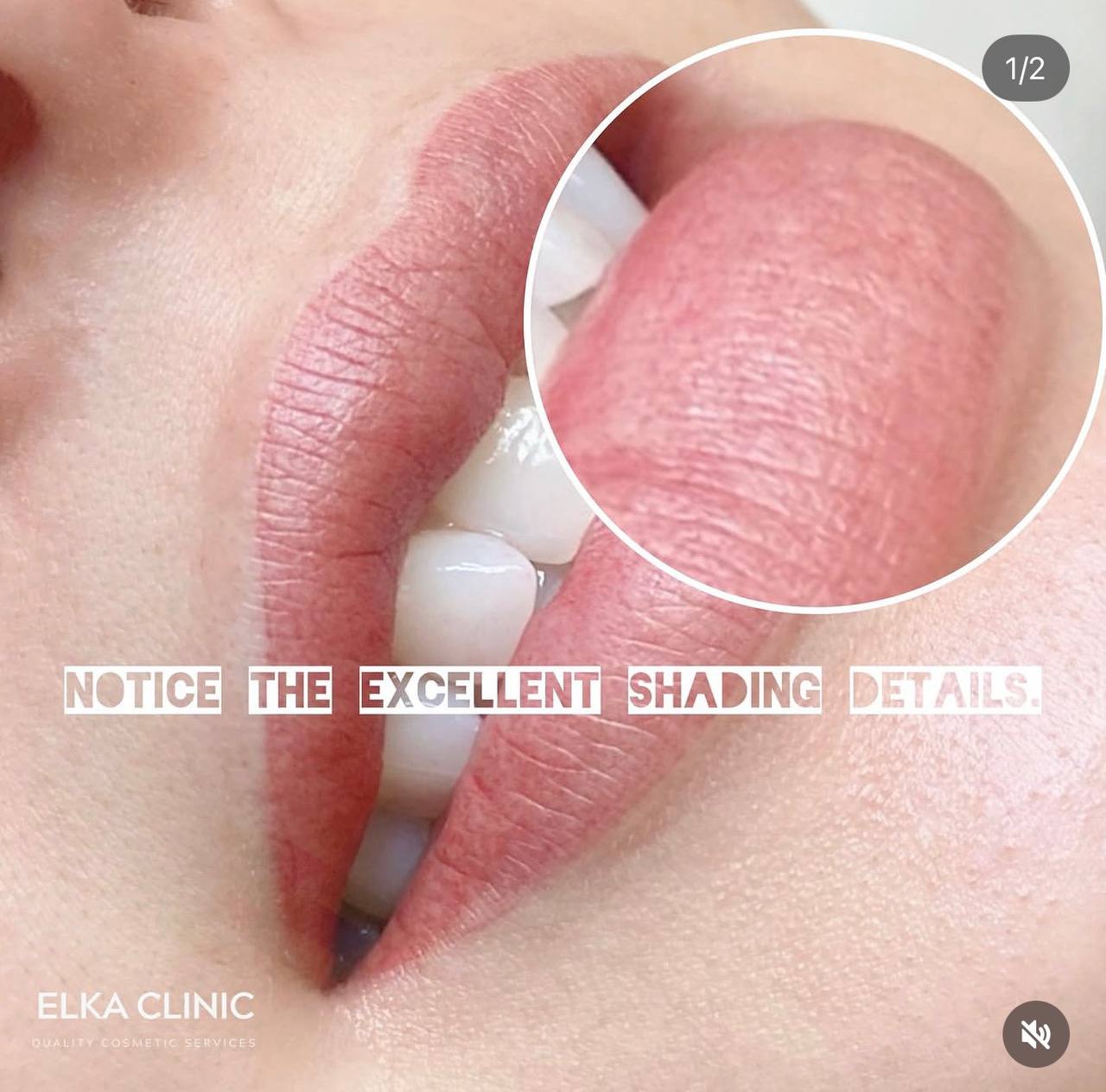 Close-up detail of lip blush shading by ELKA CLINIC Perth